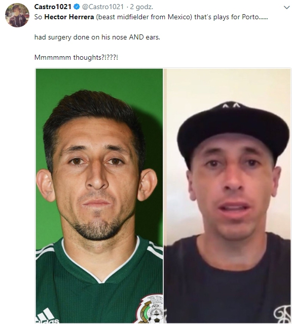 Hector Herrera przeszedł operację plastyczną... :D